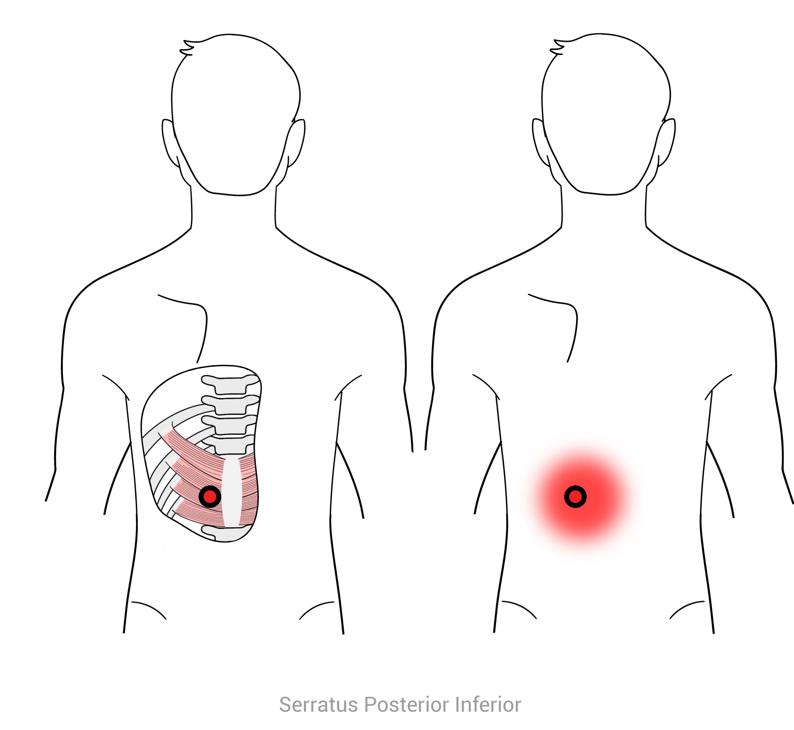 Trigger Points System